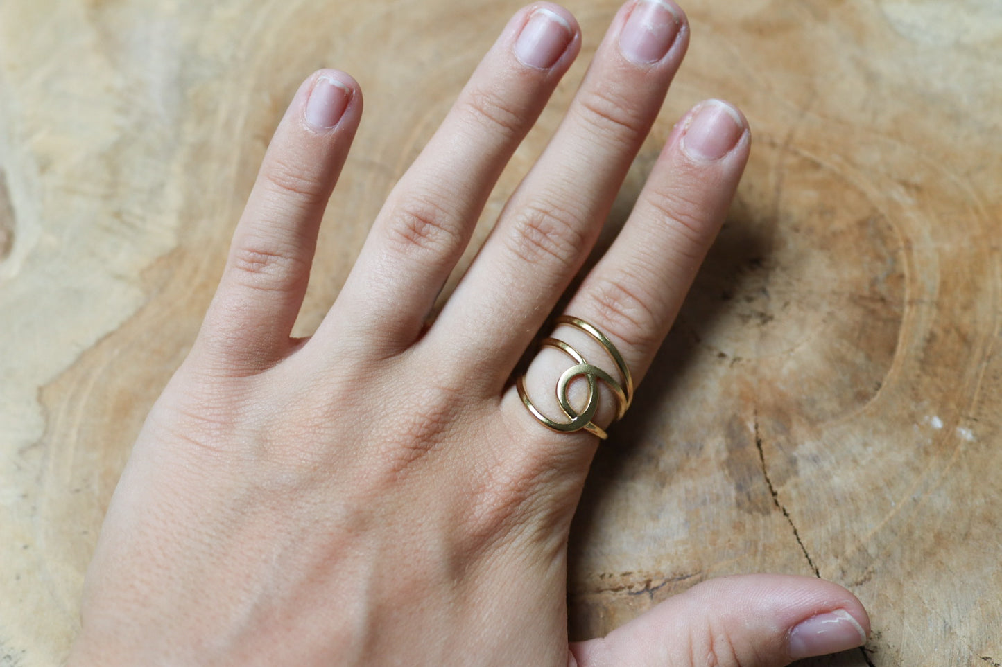 Ring ilea